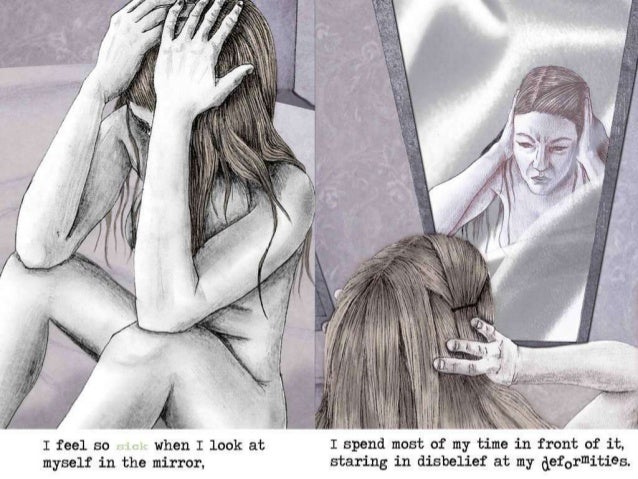 body dysmorphic disorder Body dysmorphic disorder should be diagnosed in depressed individuals if diagnostic criteria for body dysmorphic disorder is met anxiety disorders social anxiety and avoidance are common in body dysmorphic disorder. body dysmorphic disorder Body dysmorphic disorder should be diagnosed in depressed individuals if diagnostic criteria for body dysmorphic disorder is met anxiety disorders social anxiety and avoidance are common in body dysmorphic disorder.