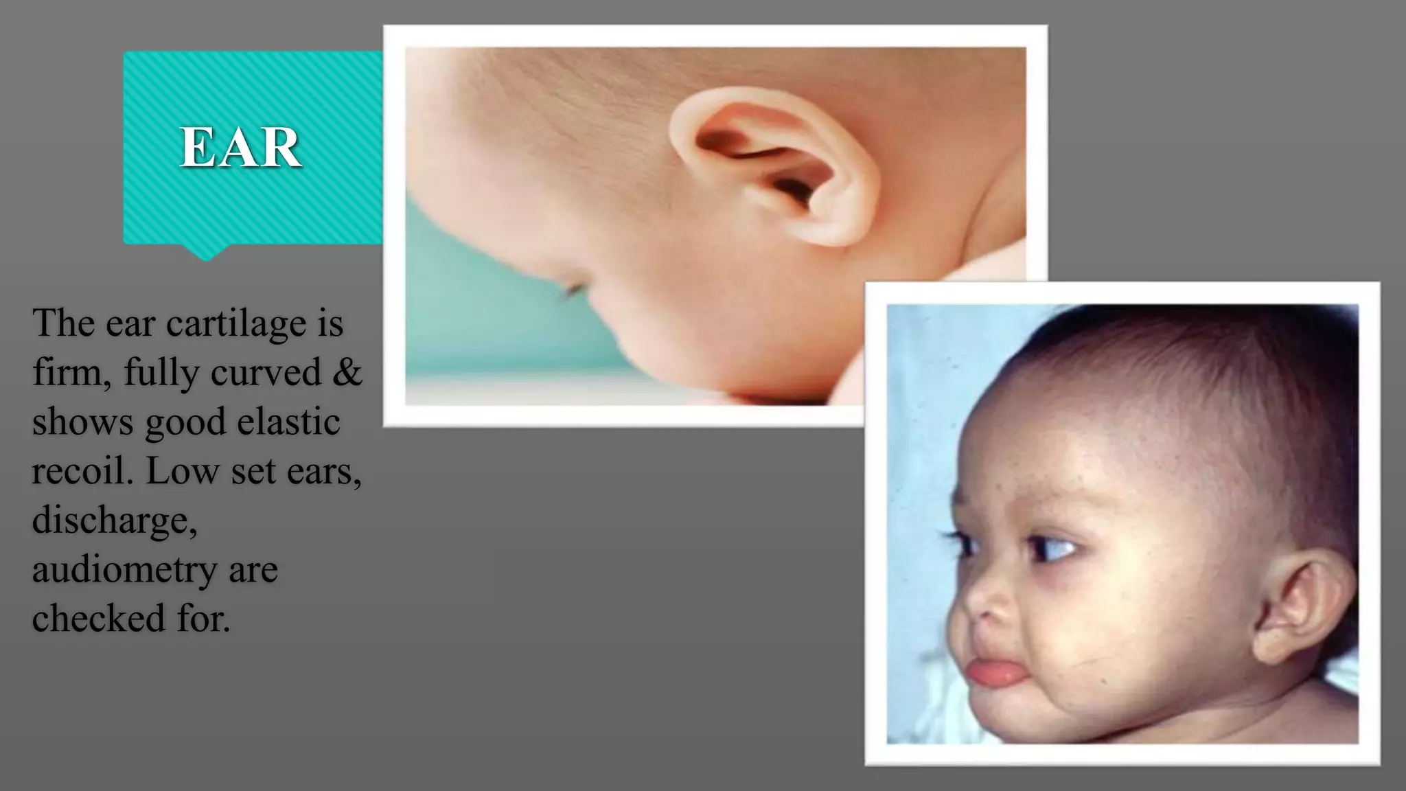 Characteristics of a Healthy Newborn | PPTX