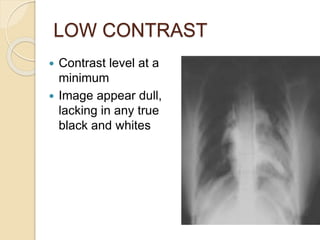 LOW CONTRAST
 Contrast level at a
minimum
 Image appear dull,
lacking in any true
black and whites
 