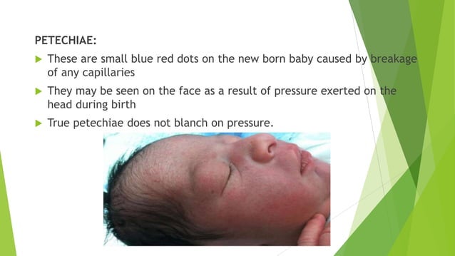 Characteristics of new normal newborn 1 pptx Pregnancy Reproductive