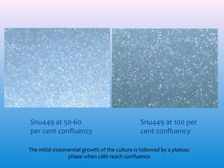 ∗ Snu449 at 50-60
per cent confluency

∗ Snu449 at 100 per
cent confluency

The initial exponential growth of the culture is followed by a plateau
phase when cells reach confluence

 