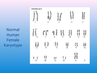 Normal
Human
Female
Karyotype

 