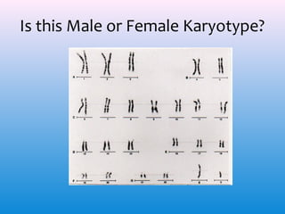 Is this Male or Female Karyotype?

 