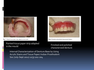 Characterization of complete denture | PPTX
