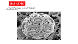 (Emiliania huxleyi, a haptophyte alga)
http://starcentral.mbl.edu/
SEM IMAGE
 