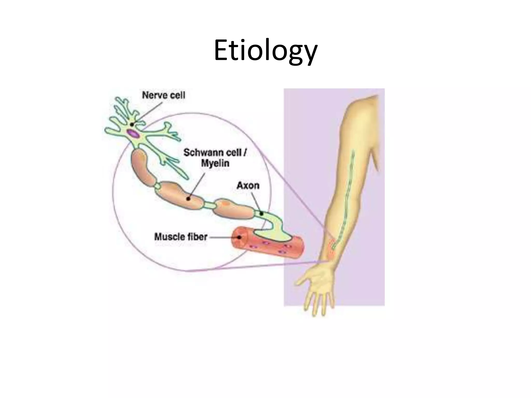 Charcot marie tooth disease PPTX