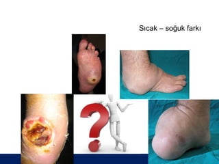 Sıcak – soğuk farkı




                ÖĞÜT
                 ÖĞÜT
 