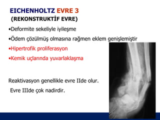 EICHENHOLTZ EVRE 3
 (REKONSTRUKTİF EVRE)
•Deformite sekeliyle iyileşme
•Ödem çözülmüş olmasına rağmen eklem genişlemiştir
•Hipertrofik proliferasyon
•Kemik uçlarında yuvarlaklaşma



Reaktivasyon genellikle evre IIde olur.
Evre IIIde çok nadirdir.



                                                     ÖĞÜT
                                                      ÖĞÜT
 