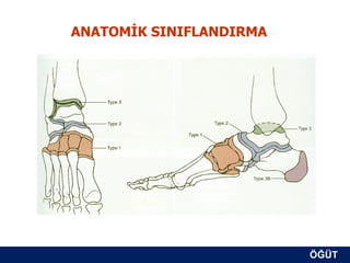 ANATOMİK SINIFLANDIRMA




                         ÖĞÜT
                          ÖĞÜT
 