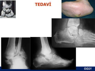 TEDAVİ




         ÖĞÜT
          ÖĞÜT
 