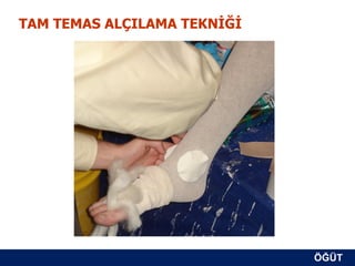 TAM TEMAS ALÇILAMA TEKNİĞİ




                             ÖĞÜT
                              ÖĞÜT
 