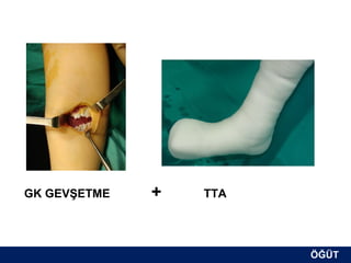 GK GEVŞETME   +   TTA




                        ÖĞÜT
                         ÖĞÜT
 