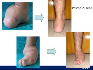 Postop 2. sene




       ÖĞÜT
        ÖĞÜT
 