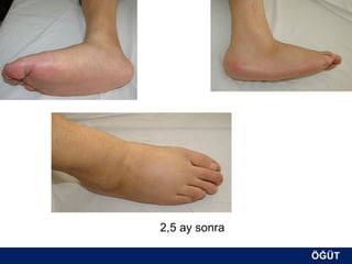 2,5 ay sonra

               ÖĞÜT
                ÖĞÜT
 