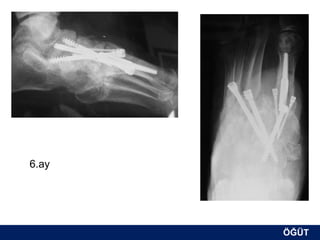 6.ay




       ÖĞÜT
        ÖĞÜT
 