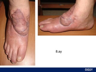 8.ay




       ÖĞÜT
        ÖĞÜT
 