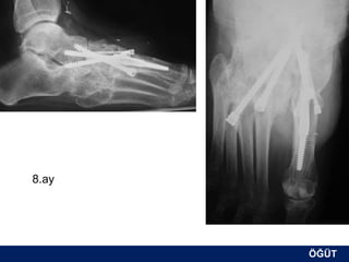 8.ay




       ÖĞÜT
        ÖĞÜT
 