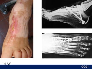 4 AY
       ÖĞÜT
        ÖĞÜT
 