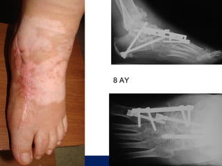 8 AY




       ÖĞÜT
        ÖĞÜT
 