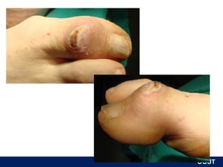 HE, 70y,K




            ÖĞÜT
             ÖĞÜT
 