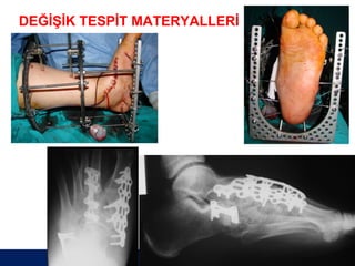 DEĞİŞİK TESPİT MATERYALLERİ




                              ÖĞÜT
                               ÖĞÜT
 