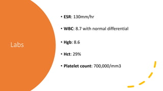 Labs
• ESR: 130mm/hr
• WBC: 8.7 with normal differential
• Hgb: 8.6
• Hct: 29%
• Platelet count: 700,000/mm3
 