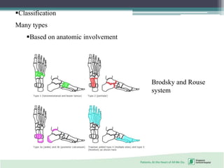 Classification
Many types
Based on anatomic involvement
Brodsky and Rouse
system
 
