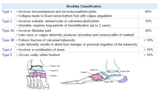 Charcot foot