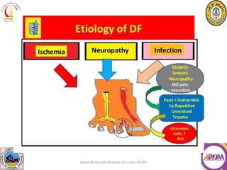 Charcot neuropathy. | PDF