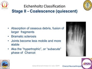 Charcot neuropathy. | PDF