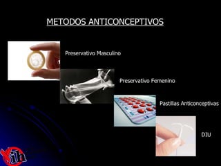 METODOS ANTICONCEPTIVOS Preservativo Masculino Preservativo Femenino DIU Pastillas Anticonceptivas 