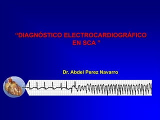 Dr. Abdel Perez Navarro
“DIAGNÓSTICO ELECTROCARDIOGRÁFICO
EN SCA ”
 