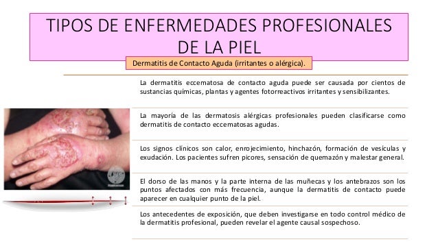 A atopicheskom la dermatitis público el tratamiento