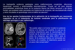 Lic.: Frank Patiño C. Seminario Azuero 2018
La tractografía evidencia patologías como malformaciones congénitas, afecciones
isquémicas, tumoral y enfermedades desmielinizantes. “Puede ser útil para detectar
anormalidades anatómicas leves en la sustancia blanca del lóbulo temporal y del lóbulo
frontal, que pudiesen estar asociadas con trastornos de conducta, del neurodesarrollo infantil
y otros vinculados al aprendizaje como el déficit de atención”.
Uno de los aportes fundamentales de la aplicación de la tractografía por resonancia
magnética es en el tratamiento de tumores cerebrales para la planificación del
abordaje quirúrgico o por radiocirugía..
“Se puede saber si el tumor invade la sustancia
blanca o la rechaza sin invadirla, lo cual es de
extrema importancia para el neurocirujano, en
función de la decisión que tome para abordarlo
sobre los márgenes que debe definir para la
lesión. Si la sustancia blanca es rechazada por
el tumor, sin invadirla, el tratamiento puede ser
un poco más conservador”.
 