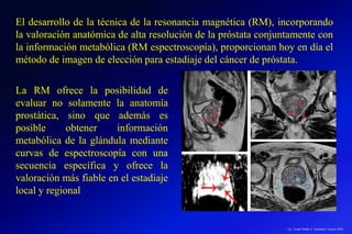 Lic.: Frank Patiño C. Seminario Azuero 2018
El desarrollo de la técnica de la resonancia magnética (RM), incorporando
la valoración anatómica de alta resolución de la próstata conjuntamente con
la información metabólica (RM espectroscopía), proporcionan hoy en día el
método de imagen de elección para estadiaje del cáncer de próstata.
La RM ofrece la posibilidad de
evaluar no solamente la anatomía
prostática, sino que además es
posible obtener información
metabólica de la glándula mediante
curvas de espectroscopía con una
secuencia específica y ofrece la
valoración más fiable en el estadiaje
local y regional
 