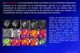 Lic.: Frank Patiño C. Seminario Azuero 2018
La RM CARDIACA ha evolucionado hasta convertirse en una modalidad diagnóstica
esencial en la evaluación de la miocardiopatía, gracias a su capacidad para
caracterizar la estructura y la función del miocardio. En los últimos años ha
aumentado el interés en el potencial de las técnicas de mapeo que aportan una
cuantificación directa y objetiva de las propiedades del miocardio.
Imágenes de resonancia magnética cardíaca
integral de un niño de 14 años con miocarditis
aguda. Fue hospitalizado después de cuatro
días de dolor precordial. El edema miocárdico
regional de pared media del tabique
interventricular y el edema epicárdico de las
paredes anterior, lateral e inferior se muestran
en las imágenes de cine e imágenes
ponderadas en T2. También se encontró
fibrosis / necrosis miocárdica regional en la
misma ubicación en la imagen LGE. En las
imágenes de mapeo T1, T2 y ECV, la línea de
puntos muestra el retorno de la inversión del
miocardio de "apariencia normal", excluyendo
el miocardio con edema visible o fibrosis en la
IRM convencional.
 