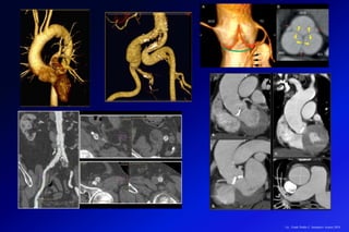 Lic.: Frank Patiño C. Seminario Azuero 2018
 