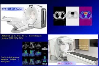 PET / CT 128 Cortes
SPECT / CT128
Reducción de la dosis de TC Reconstrucción
Iterativa ASIR (30% -50%)
Fusión de Imágenes de
Medicina Nuclear y
Tomografía
Lic.: Frank Patiño C. Seminario Azuero 2018
 