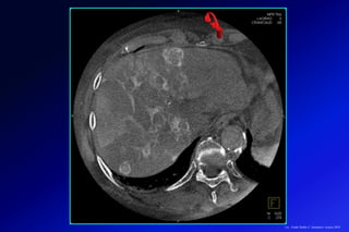 Lic.: Frank Patiño C. Seminario Azuero 2018
 