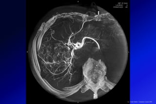 Lic.: Frank Patiño C. Seminario Azuero 2018
 