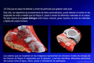 Un Chip que es capaz de detectar y contar las partículas que golpean cada píxel.
Este chip, con algoritmos de procesamiento de datos personalizados, puede detectar el cambio en las
longitudes de onda a medida que los Rayos X, pasan a través de diferentes materiales en el cuerpo.
De esta manera el se puede distinguir entre hueso, músculo, grasa, líquidos y el resto de materiales
y tejidos del cuerpo humano.
Los colores que se muestran en las imágenes representan los diversos niveles de energía de
los fotones de Rayos X registrados por el detector, y permite identificar diferentes elementos
del cuerpo como el agua, calcio, grasa e indicadores de patologías. Lic.: Frank Patiño C. Seminario Azuero 2018
 
