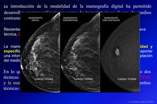 Recientemente la mamografía con tomosíntesis ha incorporado una nueva
técnica, LA MAMOGRAFÍA CON CONTRASTE.
La mamografía digital contrastada permite un incremento en la sensibilidad y
especificidad de la prueba, ayudando a la detección de lesiones ocultas al aportar
una información funcional. Es sabido que el cáncer de mama suele mostrar captación
del medio de contraste.
La introducción de la modalidad de la mamografía digital ha permitido
desarrollar nuevas aplicaciones como la tomosíntesis y el uso de medios
contrastados iodados no factibles en la era de la mamografía analógica.
En lo que respecta a la mamografía con contraste se han desarrollado dos
técnicas diferentes de estudio: la mamografía temporal con contraste (TCEM)
y la mamografía espectral o energía dual con contraste (CESM). En ambas
técnicas se utiliza medio de contraste iodado intravenoso.
Lic.: Frank Patiño C. Seminario Azuero 2018
 