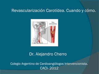 Revascularización Carotídea. Cuando y cómo.




             Dr. Alejandro Cherro

Colegio Argentino de Cardioangiólogos Intervencionista.
                     CACI- 2012
 