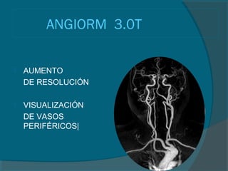 ANGIORM 3.0T

   AUMENTO
    DE RESOLUCIÓN

   VISUALIZACIÓN
    DE VASOS
    PERIFÉRICOS|
 