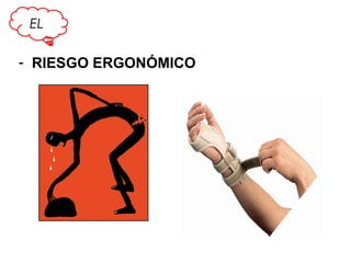 EL

- RIESGO ERGONÓMICO

 