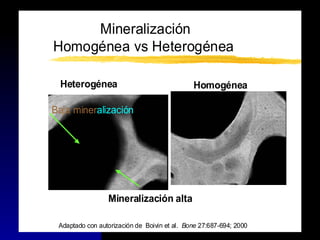 Mineralización
Homogénea vs Heterogénea
Adaptado con autorización de Boivin et al. Bone 27:687-694; 2000
Heterogénea Homogénea
Baja mineralización
Mineralización alta
 