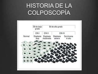 HISTORIA DE LA
COLPOSCOPÍA
 