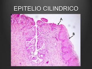 EPITELIO CILINDRICO
 