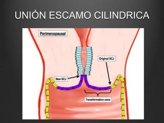 UNIÓN ESCAMO CILINDRICA
 