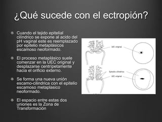 ¿Qué sucede con el ectropión?
Cuando el tejido epitelial
cilíndrico se expone al acido del
pH vaginal este es reemplazado
por epitelio metaplásicos
escamoso neoformado.
El proceso metaplásico suele
comenzar en la UEC original y
desplazarse centrípetamente
hacia el orificio externo.
Se forma una nueva unión
escamo-cilindrica con el epitelio
escamoso metaplasico
neoformado.
El espacio entre estas dos
uniones es la Zona de
Transformación
 